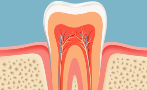 根管治疗容易出现的问题！