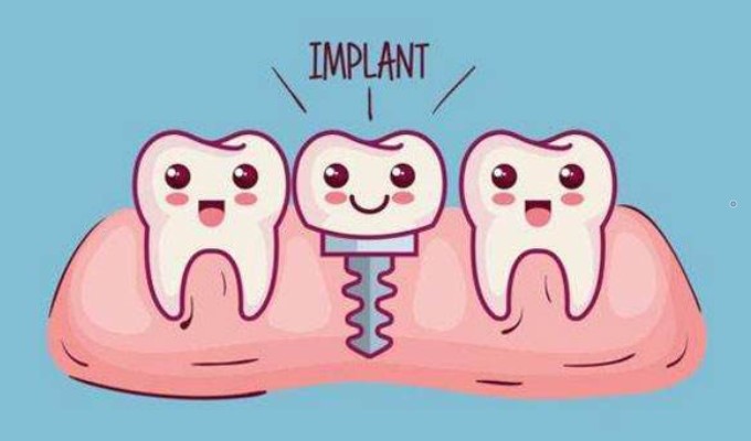 口腔种植牙详细介绍,患者再问用它! 口腔种植牙详细介绍,患者再问用它!