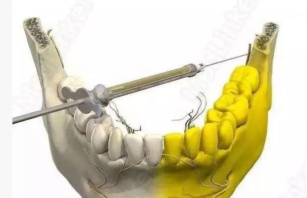 口腔科急救预案! 口腔科急救预案!