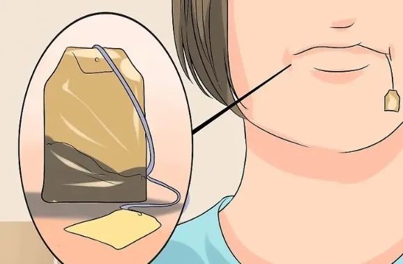 拔牙后，如何促进牙龈伤口愈合？—义乌傅氏口腔