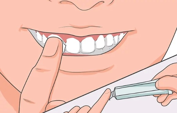 拔牙后，如何促进牙龈伤口愈合？—义乌傅氏口腔