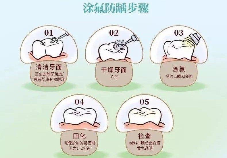 儿童窝沟封闭、涂氟后就不再长龋齿了？