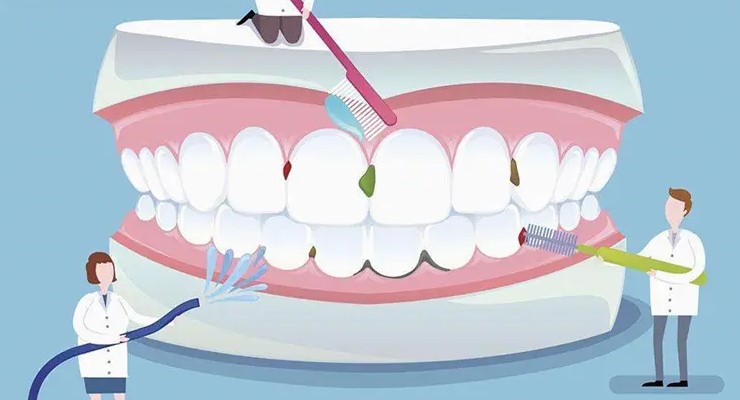 如何正确使用暂封粘固材?—义乌口腔医院 如何正确使用暂封粘固材?—义乌口腔医院