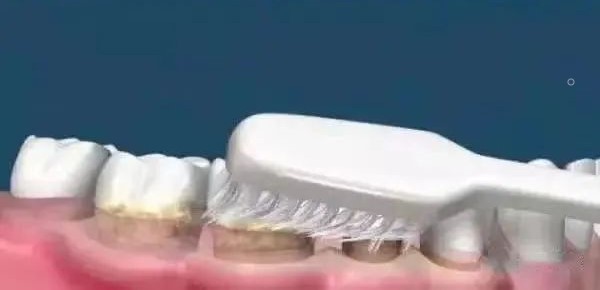 洗牙与牙周刮治的区别！