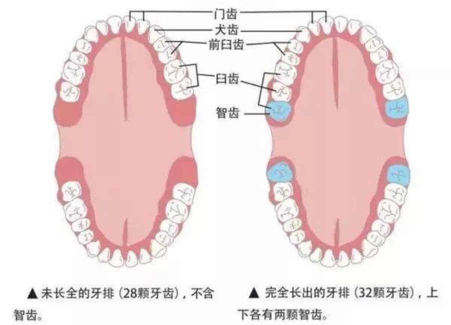 智齿总是发炎，什么时候拔掉才好？—义乌傅氏口腔