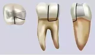 牙齿急救知识分享!—义乌傅氏口腔 牙齿急救知识分享!—义乌傅氏口腔