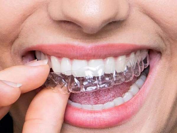 什么时候进行正畸治疗最合适？—义乌牙齿矫正