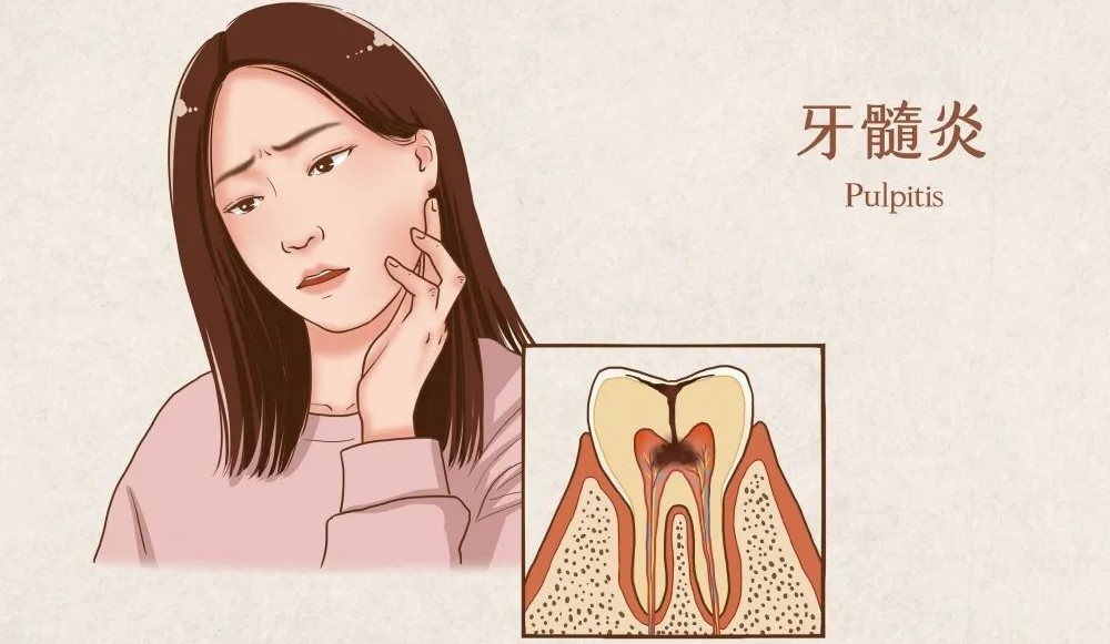 牙疼睡不着怎么办？