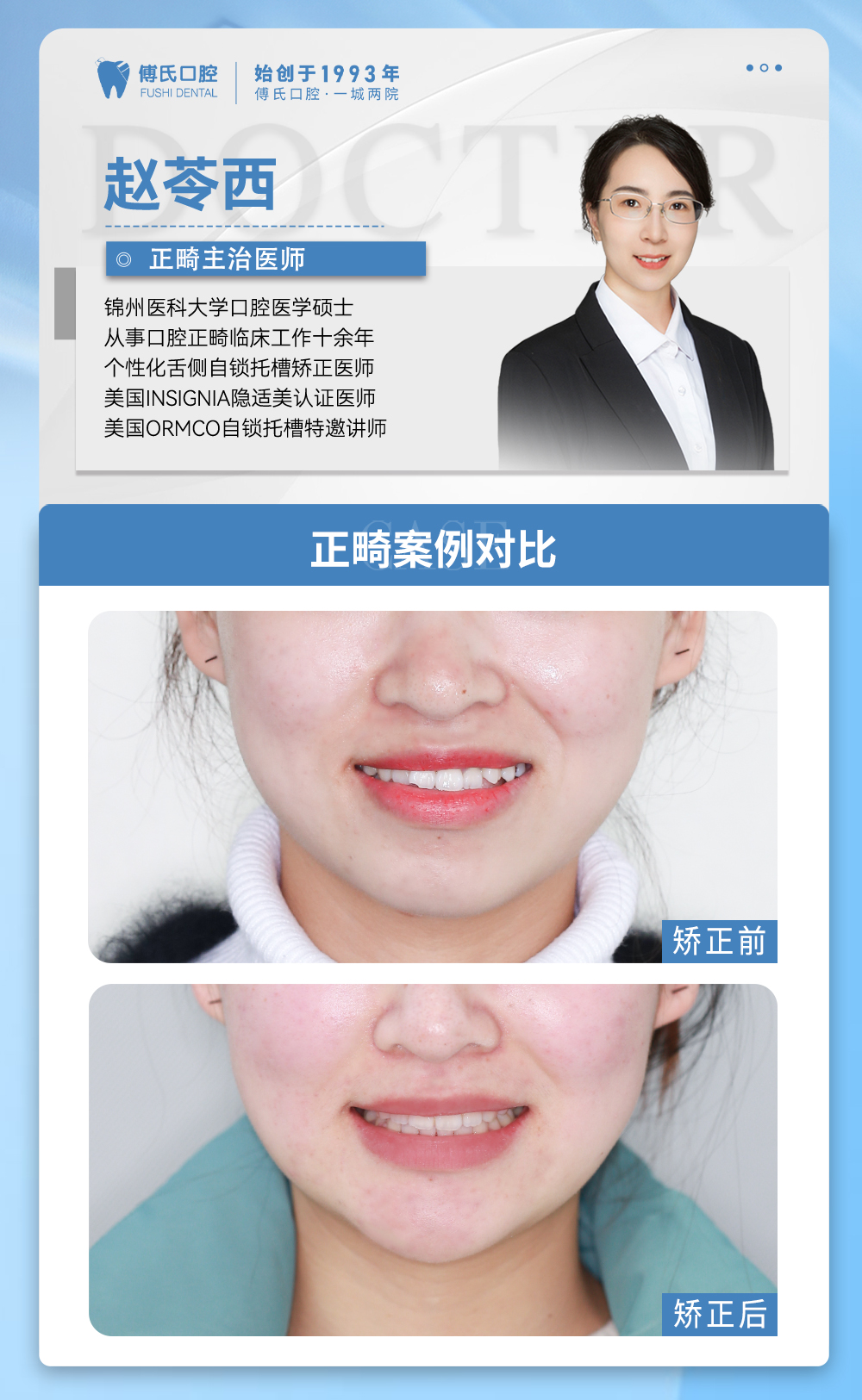 义乌傅氏口腔前牙开合，嘴凸，下巴后缩矫正案例分享！