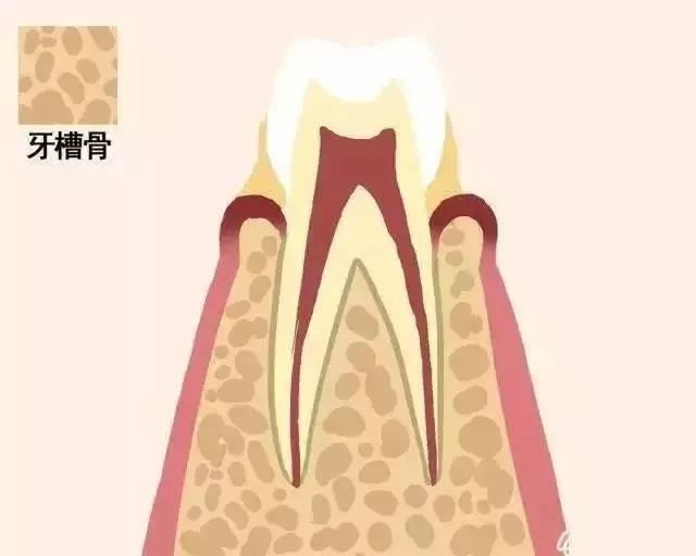 中年躲不过脱发，但能躲得过牙齿松动—义乌傅氏口腔