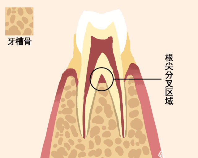 中年躲不过脱发，但能躲得过牙齿松动—义乌傅氏口腔