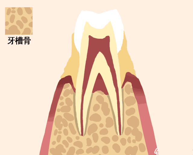 中年躲不过脱发，但能躲得过牙齿松动—义乌傅氏口腔