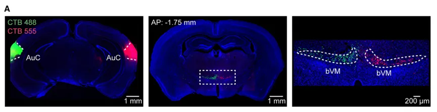 Meca Scientific PanoBrain助力填补神经科学认知空白 | “窥见”听觉处理的隐藏维度