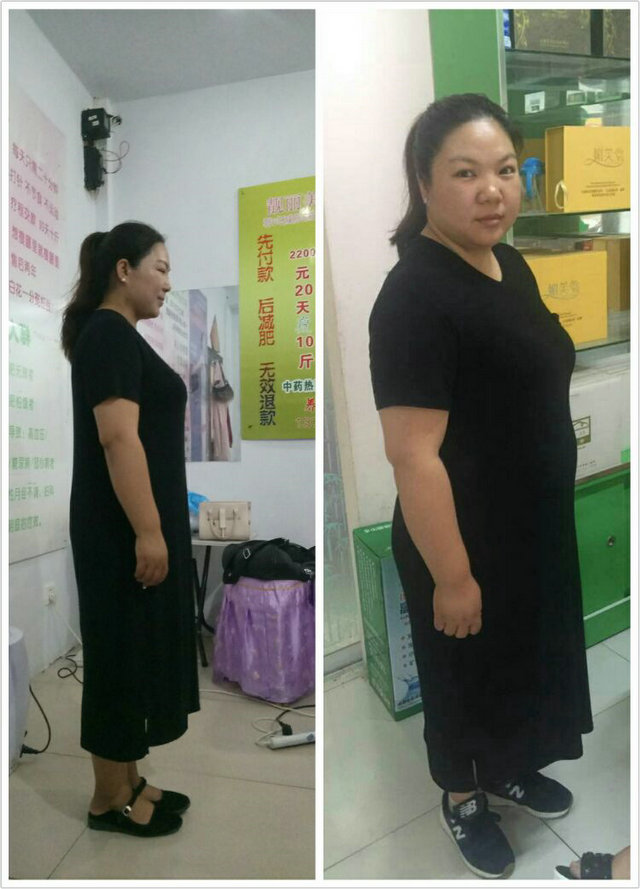 减肥成功案例