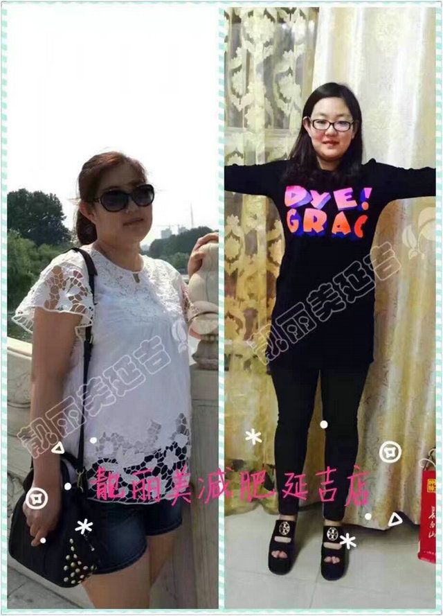 减肥成功案例