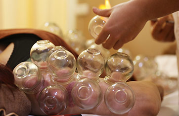 <p align="justify" style="text-align:center;">
	<span style="font-family:Microsoft YaHei;font-size:24px;color:#4D2C0A;">中医百罐瘦身</span> 
</p>