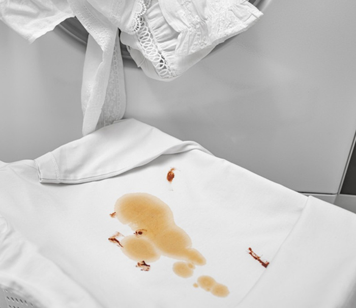 手术辅料黑暗油问题系统性解决方案