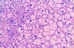Systemic Toxicity Tests
