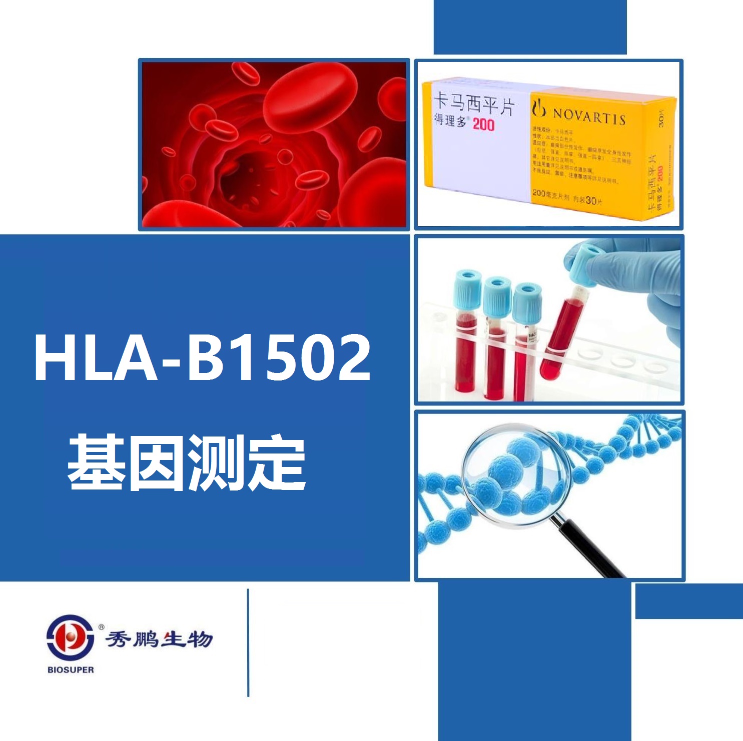 HLA-B1502基因测定