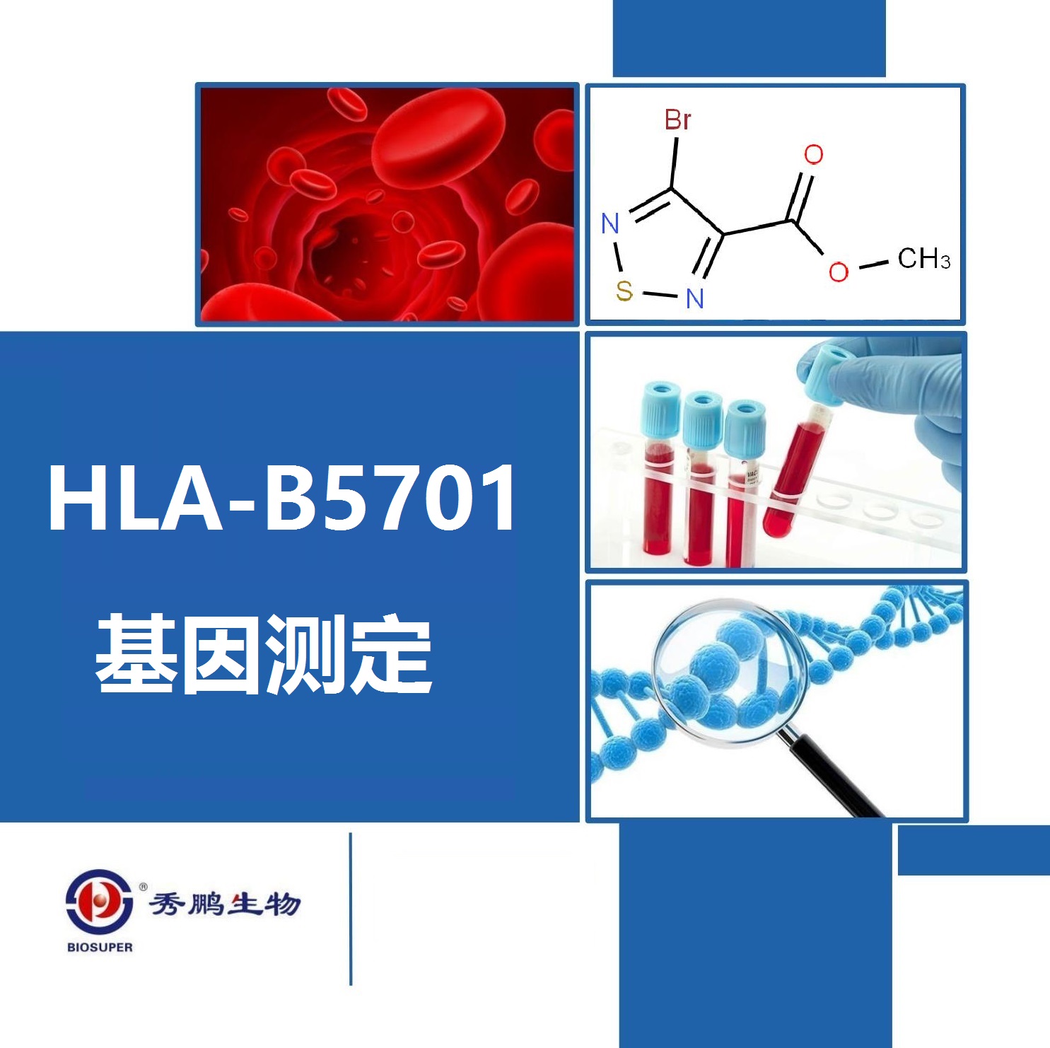 HLA-B5701基因测定