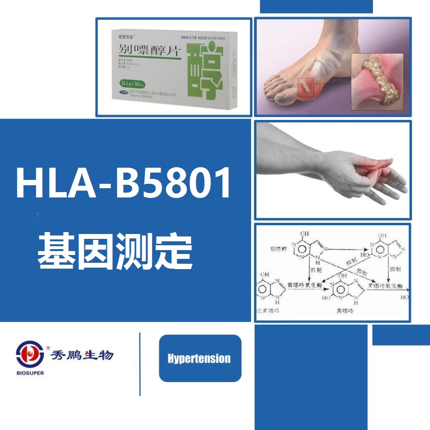 HLA-B5801基因测定