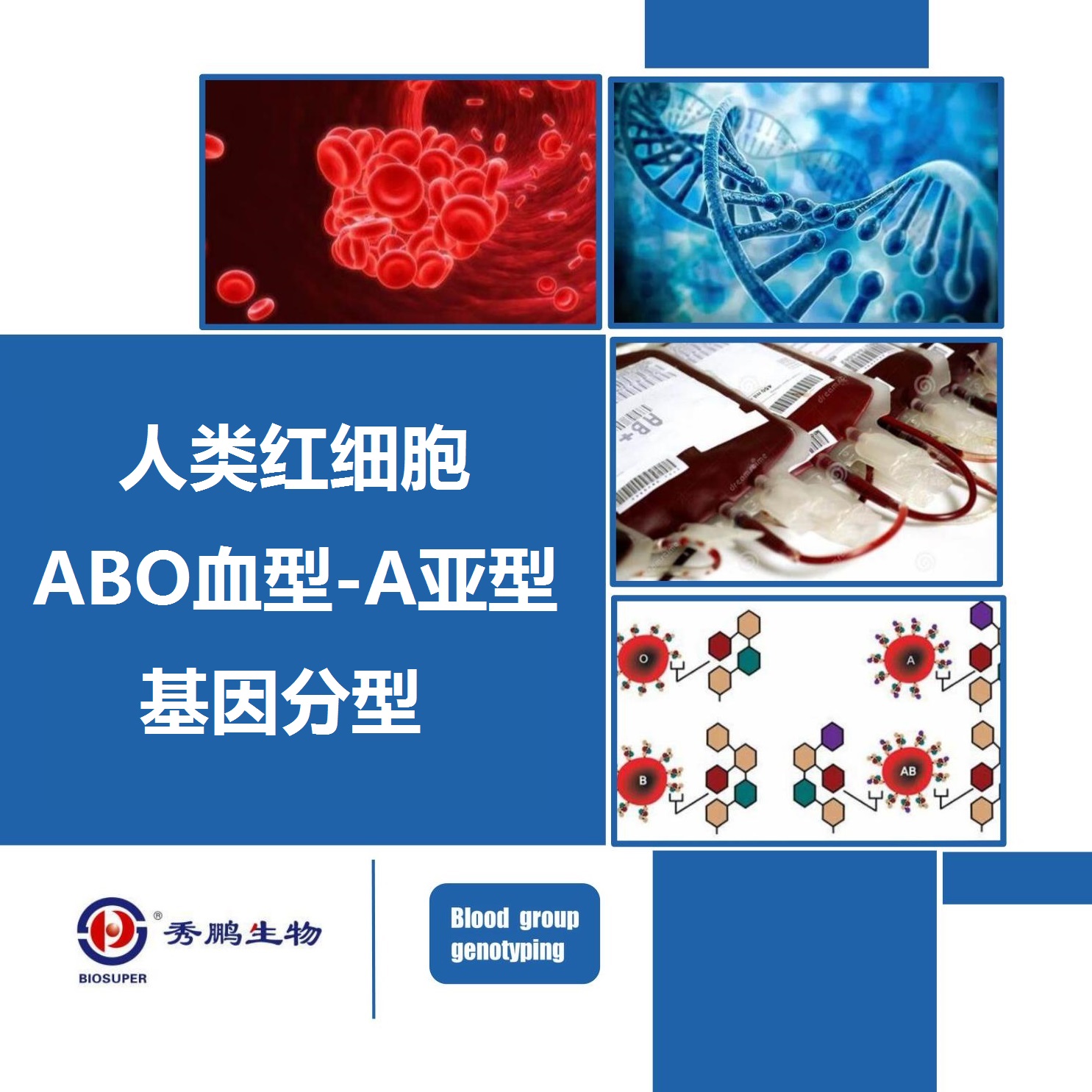 人类红细胞ABO血型-A亚型基因分型