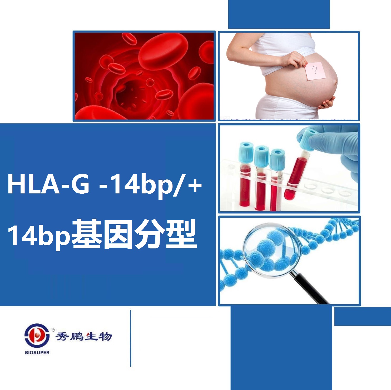 HLA-G -14bp/+14bp基因分型测定