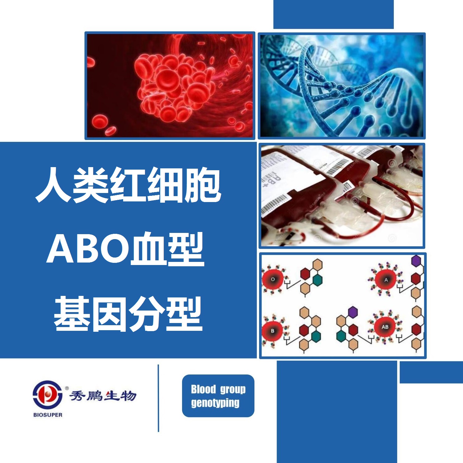 人类红细胞ABO血型基因分型