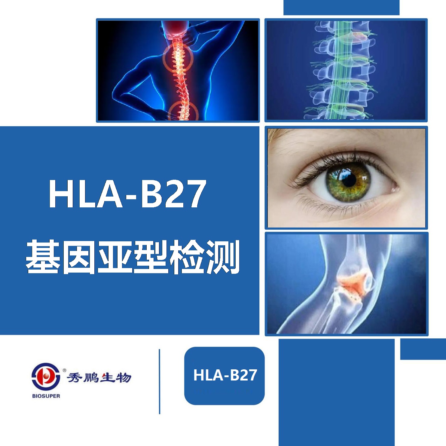 HLA-B27基因分型测定