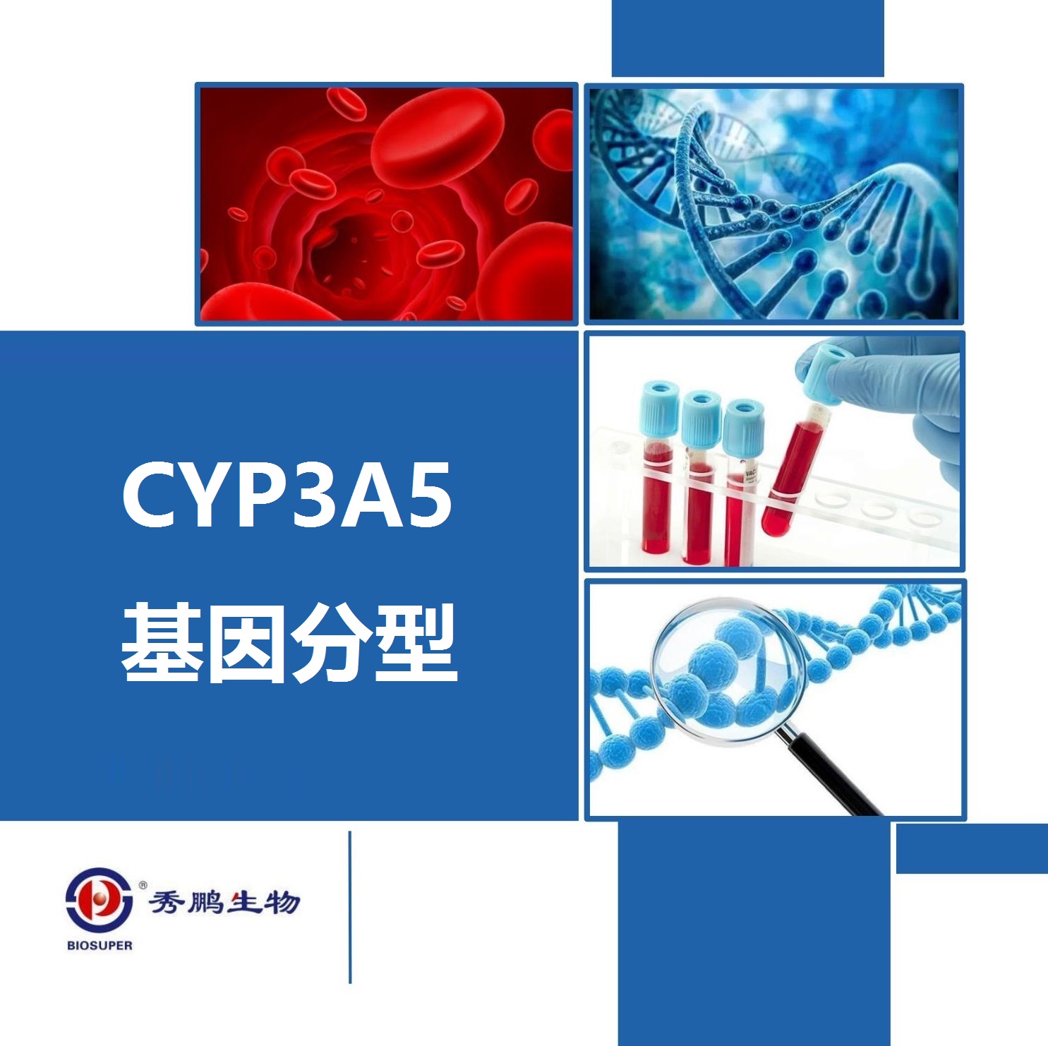 CYP3A5基因分型