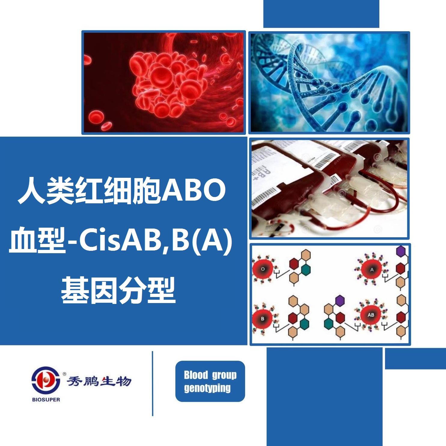 人类红细胞ABO血型-CisAB,B(A)基因分型