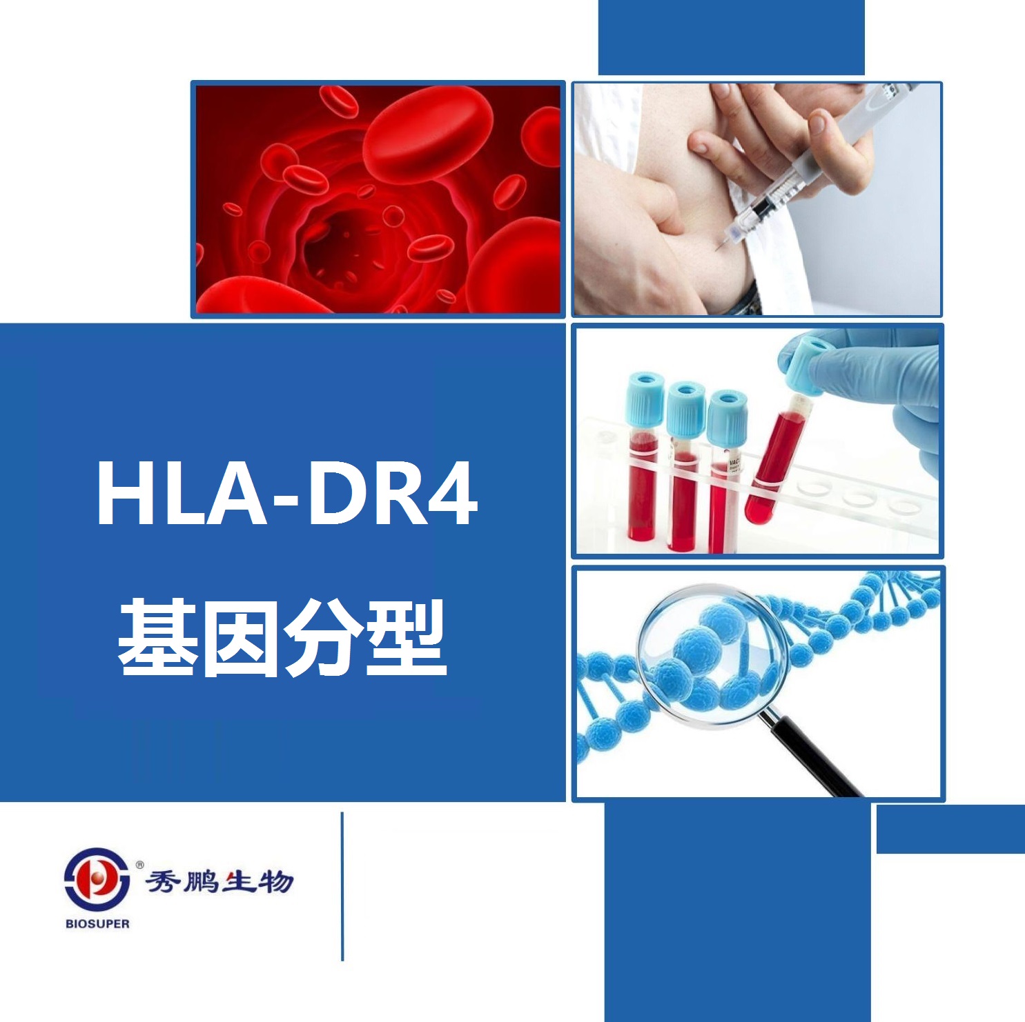 HLA-DR4基因分型测定