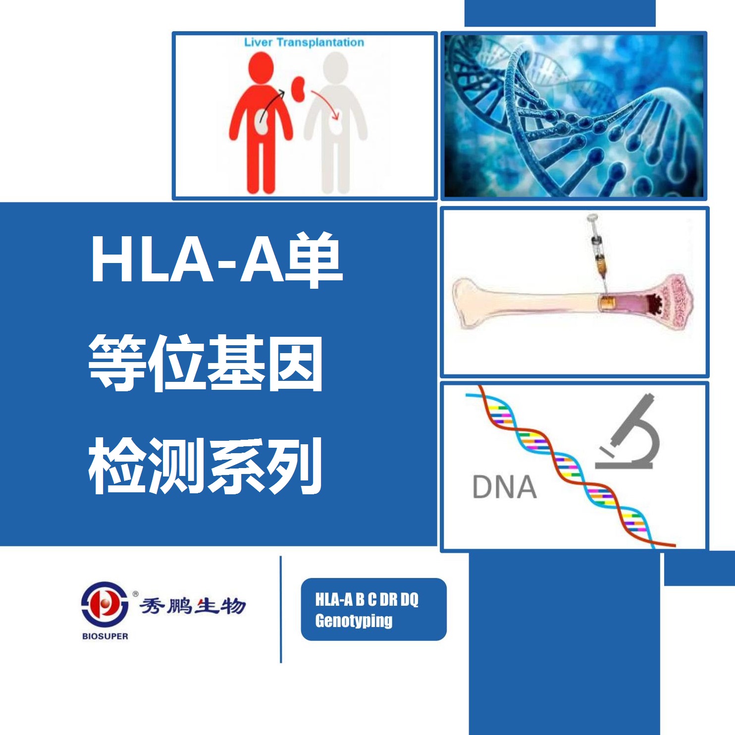 HLA-A单等位基因检测系列