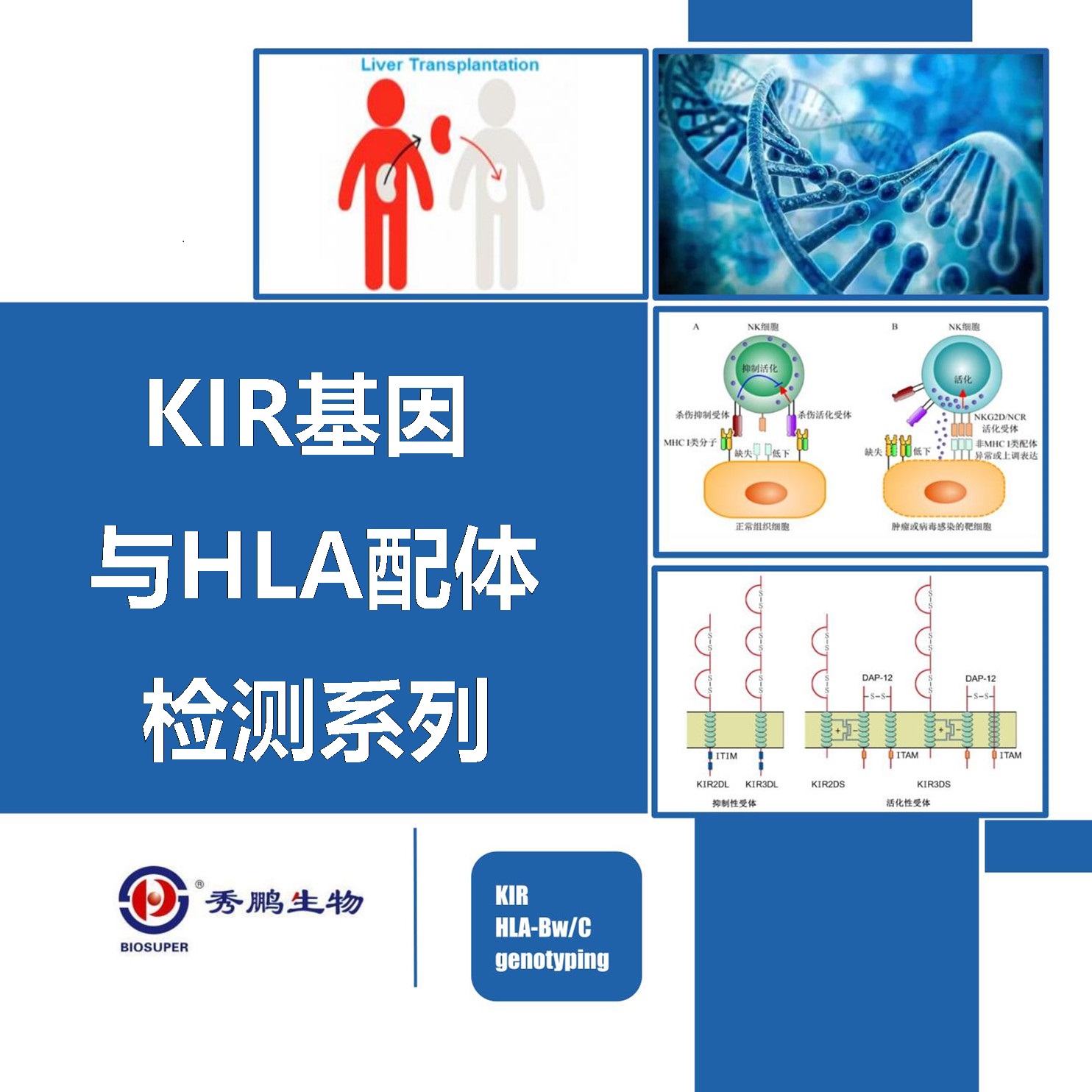 KIR基因与HLA配体检测系列