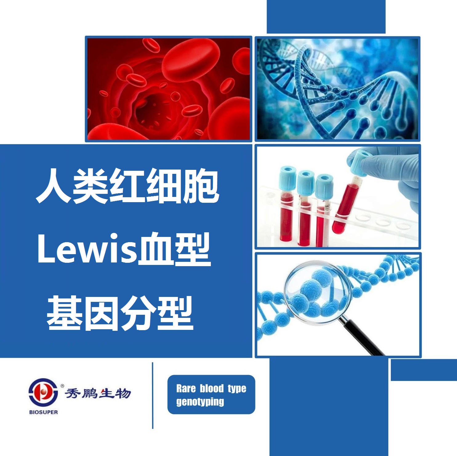 人类红细胞Lewis血型基因分型