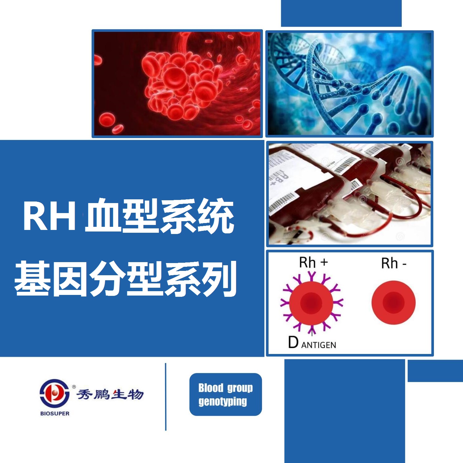 Rh血型系统基因分型系列
