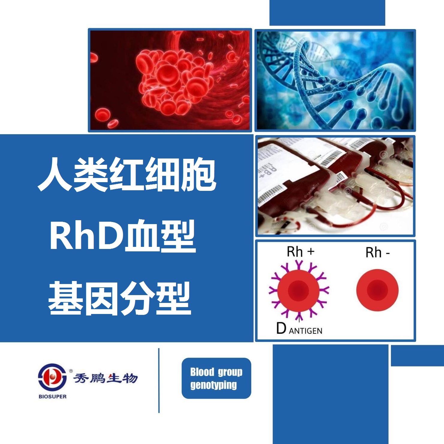 人类红细胞RhD血型基因分型