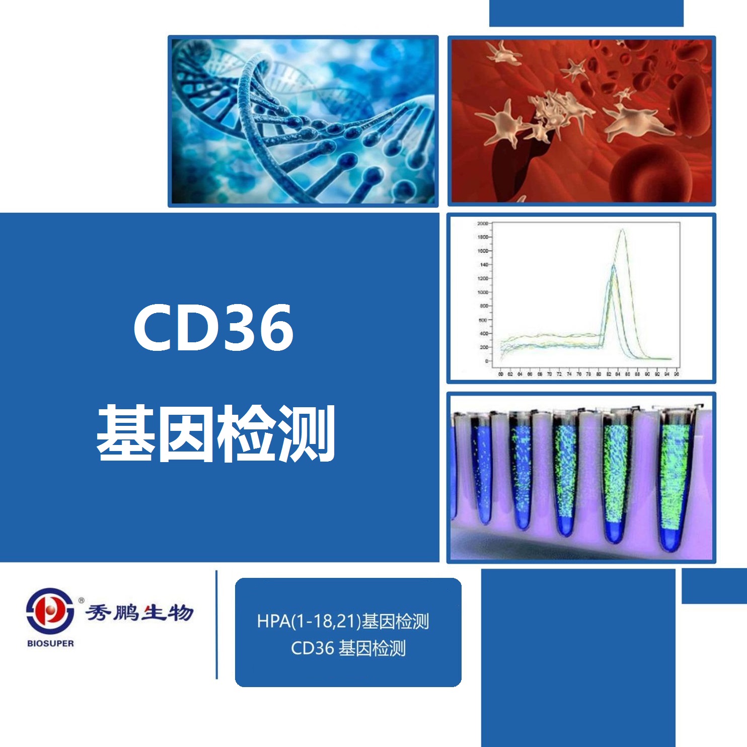 CD36基因检测