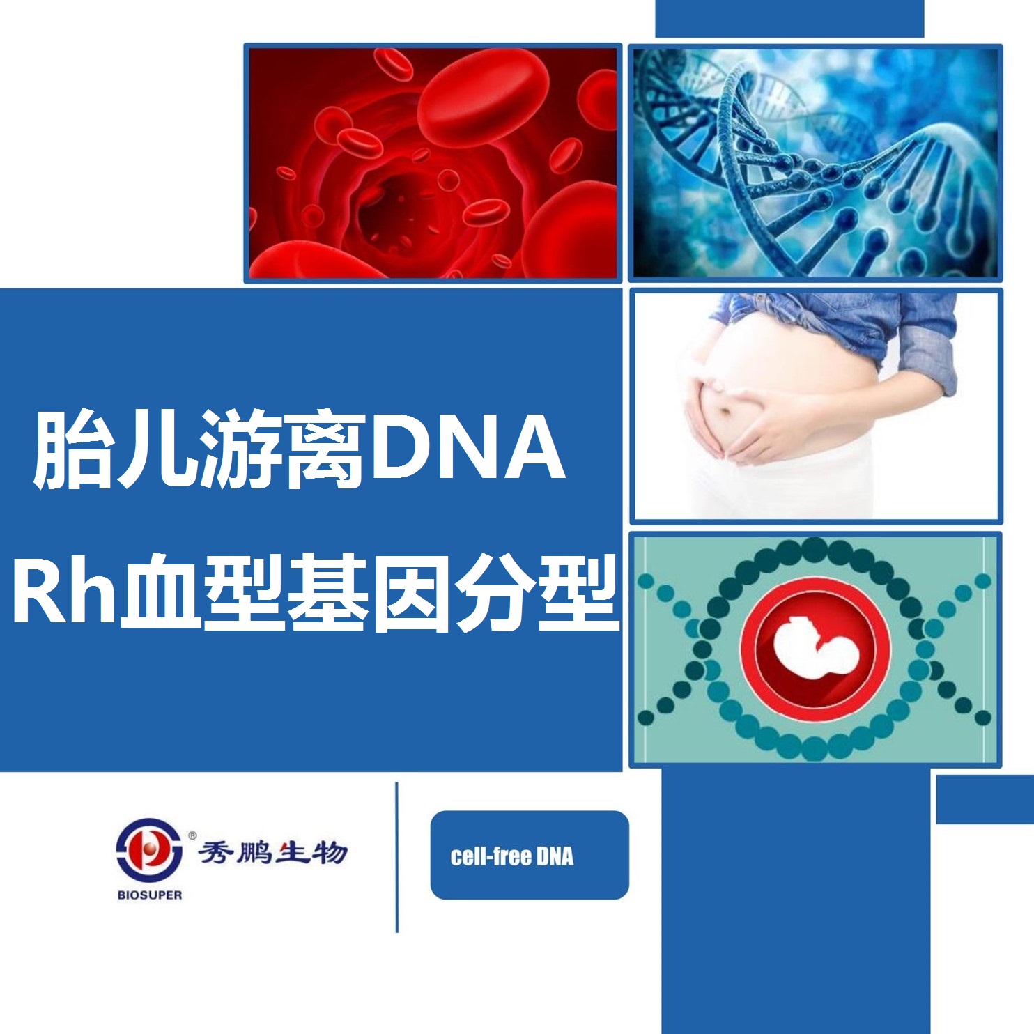 胎儿游离DNA Rh血型基因分型