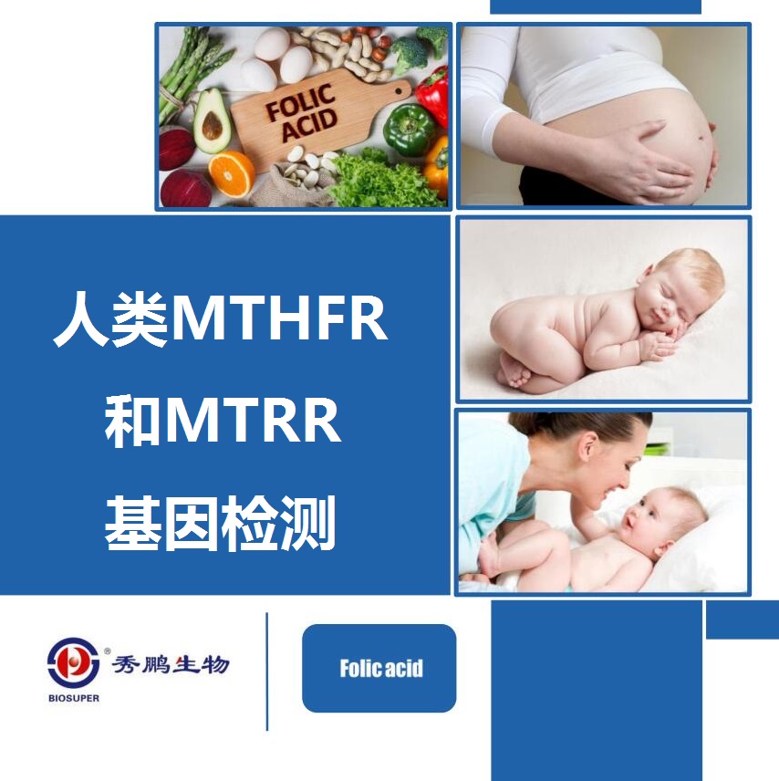 人类MTHFR和MTRR基因检测