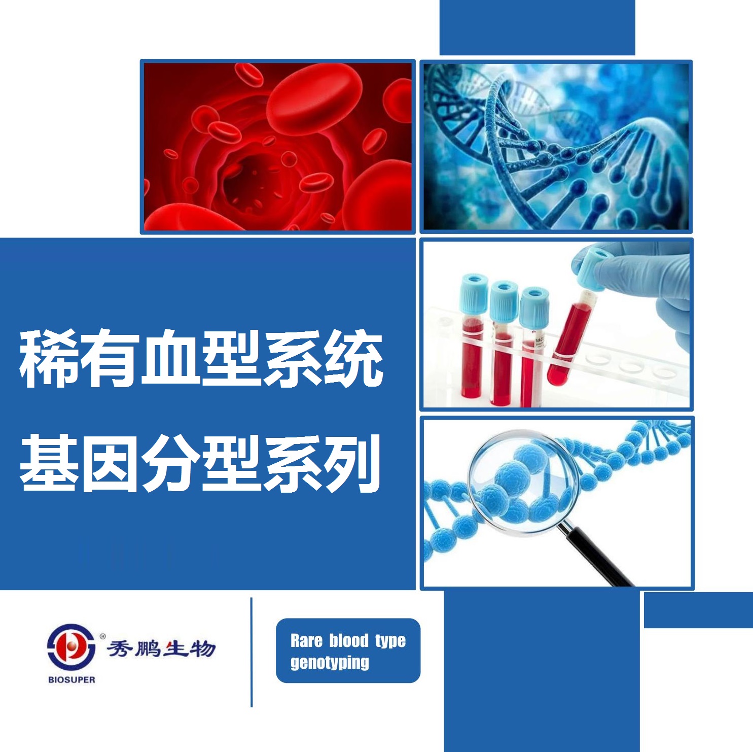 稀有血型系统基因分型检测试剂盒
