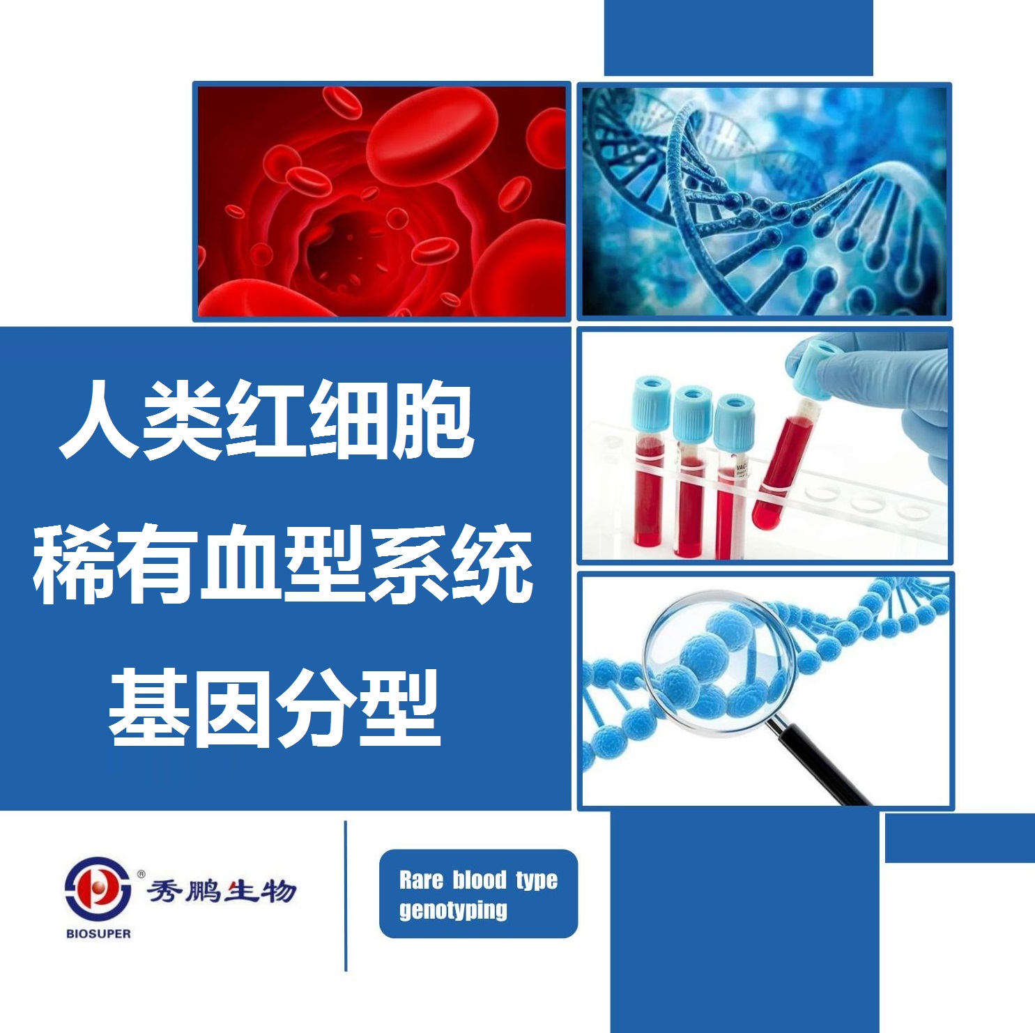 人类红细胞稀有血型系统基因分型