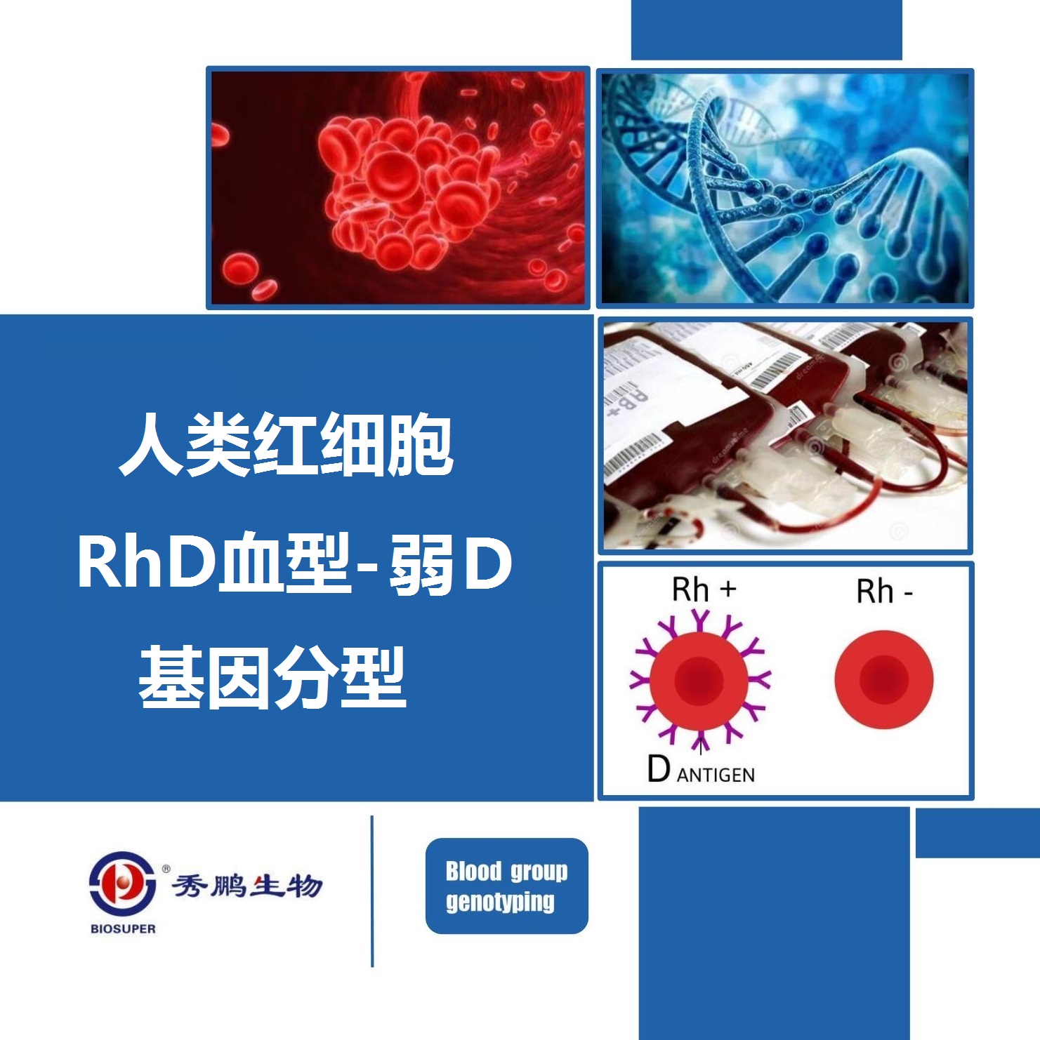 人类红细胞RhD血型-弱D基因分型