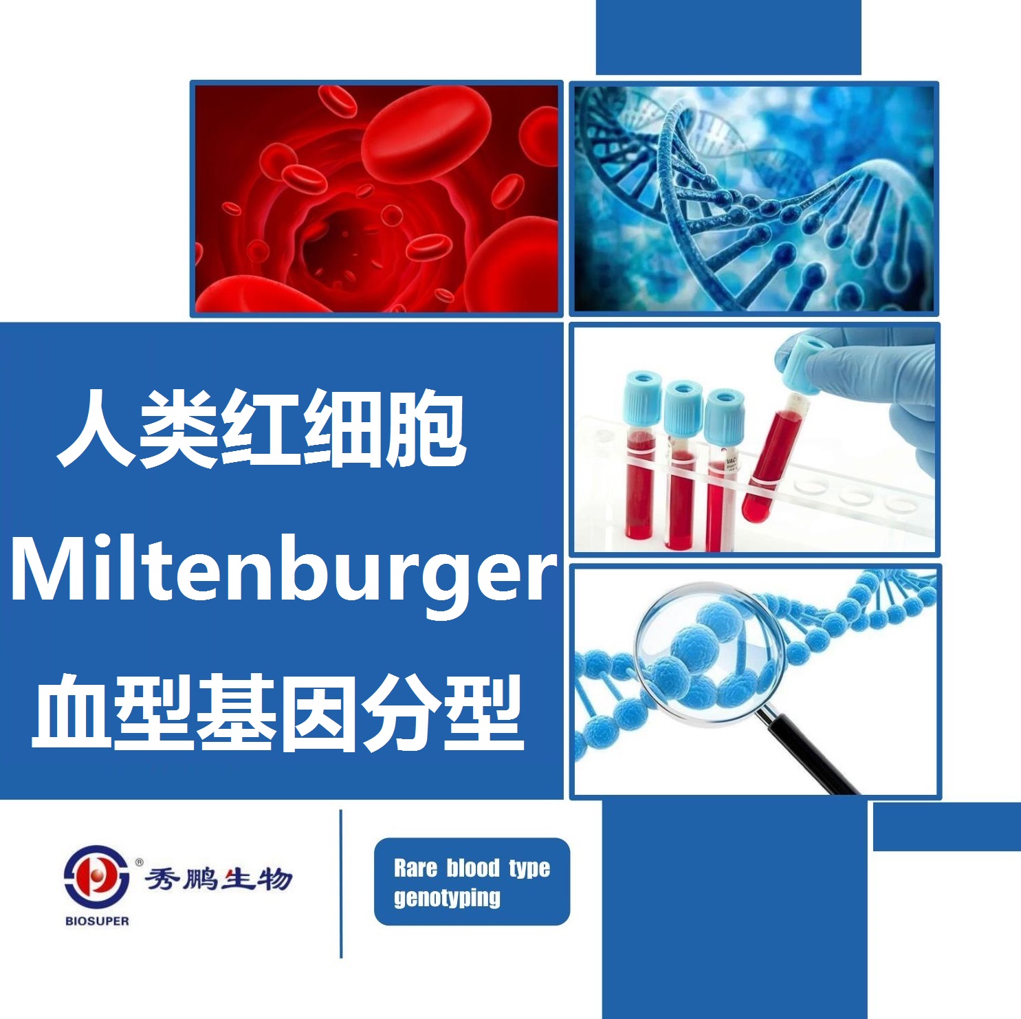 人类红细胞Miltenburger血型基因分型
