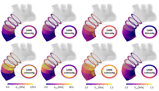 仿真软件Abaqus是如何改变生物医学研究的