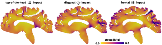仿真软件Abaqus是如何改变生物医学研究的